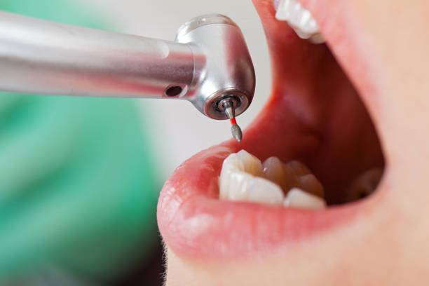 Best Emergency Treatment for Toothache in Calumet Park, IL